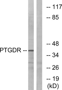 PD2R rabbit pAb