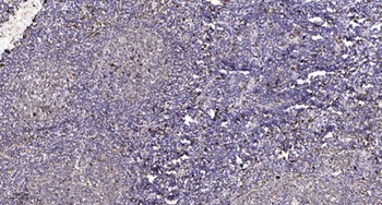 PD2R rabbit pAb