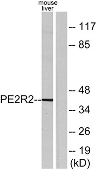 EP2 antibody