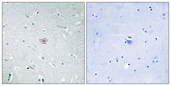 EP3 antibody