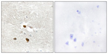 ZNF287 rabbit pAb