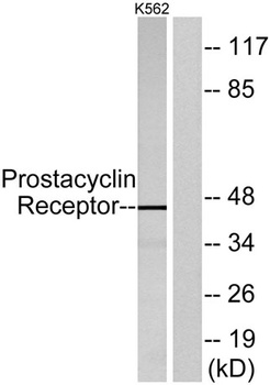 IP Receptor antibody