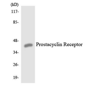 IP Receptor rabbit pAb