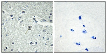 PTH antibody