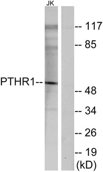 PTH/PTHrP-R rabbit pAb