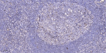 SFRS15 antibody