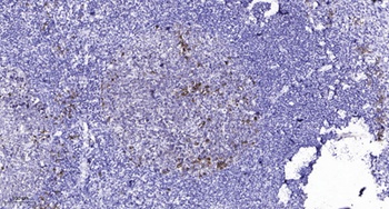 FAK (phospho-Tyr925) antibody