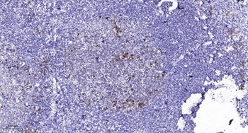 FAK (phospho Tyr925) rabbit pAb