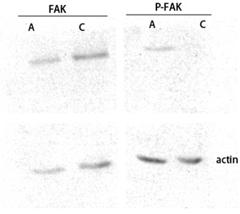 FAK (phospho Ser843) rabbit pAb