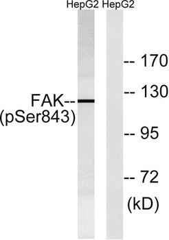 FAK (phospho Ser843) rabbit pAb