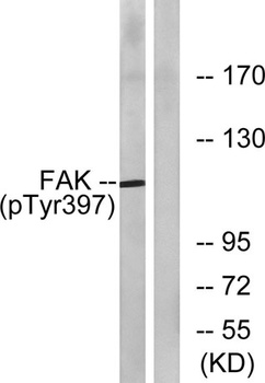FAK (phospho Tyr397) rabbit pAb