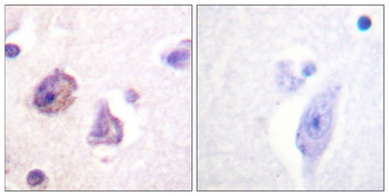 FAK (phospho-Tyr576) antibody