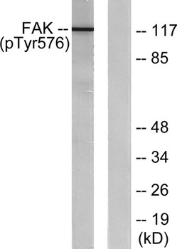 FAK (phospho Tyr576) rabbit pAb
