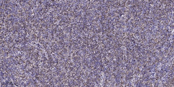 FAK (phospho Tyr577) rabbit pAb