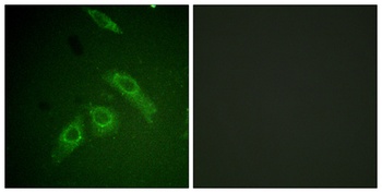 FAK (phospho Ser910) rabbit pAb
