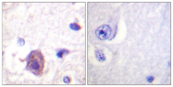 FAK (phospho Ser910) rabbit pAb