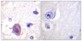 FAK (phospho-Ser910) antibody