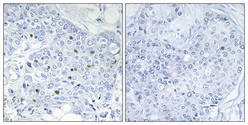 BAF250b antibody