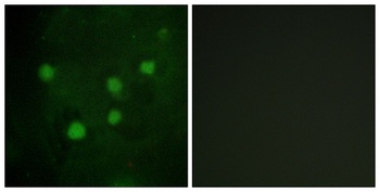 BAF250b antibody