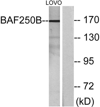 BAF250b rabbit pAb