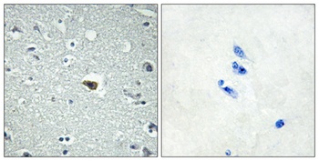 BAI-1 antibody