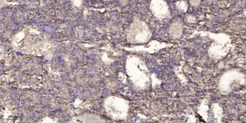 INTS2 antibody