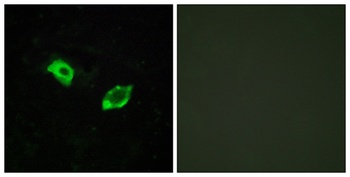 GPR158 antibody