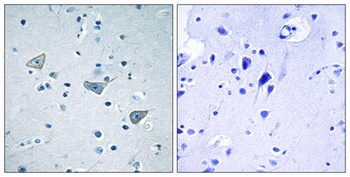 GPR158 antibody