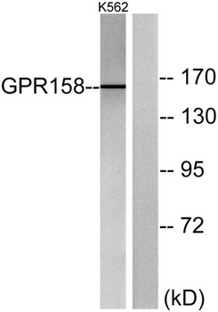 GPR158 rabbit pAb