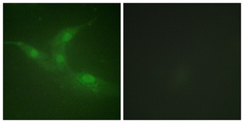Brk (phospho Tyr447) rabbit pAb