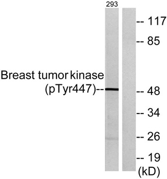 Brk (phospho Tyr447) rabbit pAb