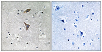 KCNT1 rabbit pAb Antibody