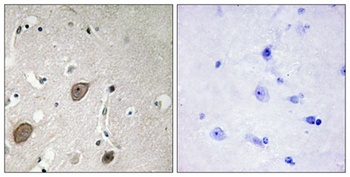 BEGAIN antibody