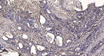 ARHGAP23 rabbit pAb Antibody
