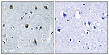 COL20A1 antibody