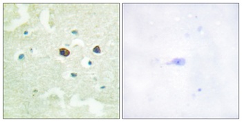 PTP1B (phospho-Ser50) antibody