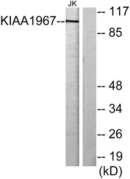 DBC-1 rabbit pAb Antibody