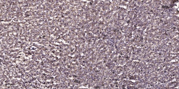 DBC-1 rabbit pAb Antibody
