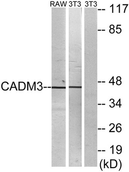 IGSF4B antibody