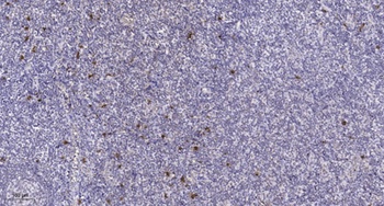 IGSF4B antibody