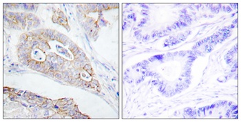 CD45 antibody