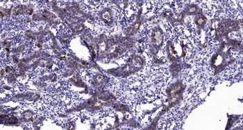 PTP IA-2beta antibody