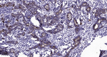 PTP IA-2β rabbit pAb
