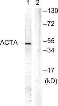 Actin-α/γ rabbit pAb