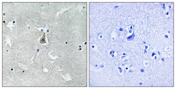 Bax (phospho-Ser184) antibody