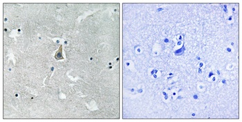 Bax (phospho Ser184) rabbit pAb