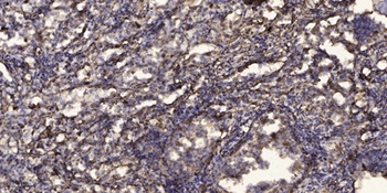 Peroxin 5 rabbit pAb