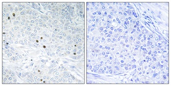 TP53INP2 rabbit pAb