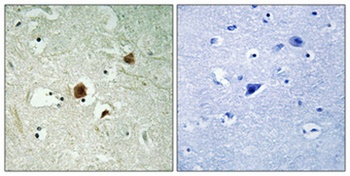 ARHGAP22 rabbit pAb Antibody