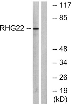 ARHGAP22 rabbit pAb Antibody